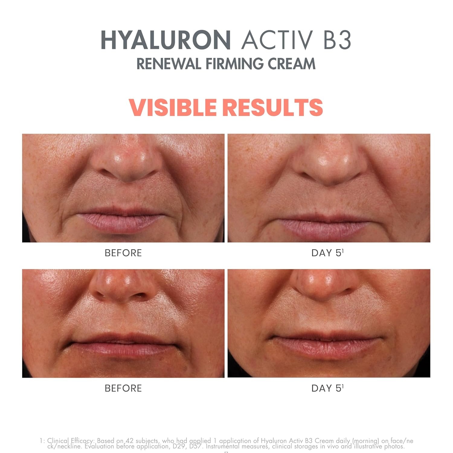 image:imageAvne Hyaluron Activ B3 Renewal Firming CreamJar
